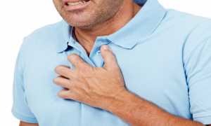 Сильно выраженная изжога: причины и лечение