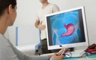 Облепиховое масло для лечения гастрита: полезные свойства и применение