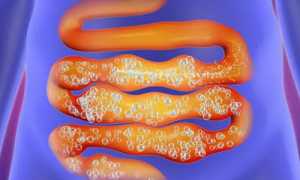 Почему пучит живот от молока: причины и советы