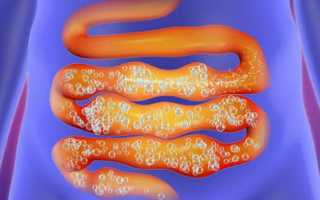 Почему пучит живот от молока: причины и советы