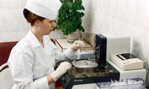 Анализ кала на наличие хеликобактер для диагностики здоровья