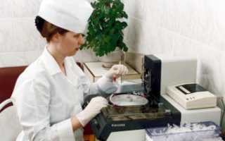 Анализ кала на наличие хеликобактер для диагностики здоровья