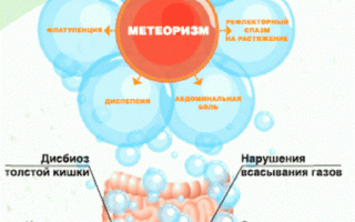 Лечение метеоризма на фоне панкреатита: советы и рекомендации