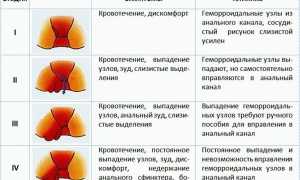 Опасность геморроя для женщин: причины и последствия