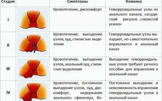 Опасность геморроя для женщин: причины и последствия