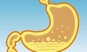 Гастродуоденит эрозивный: симптомы и лечение