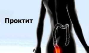 Кровь во время дефекации: причины и последствия