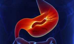 Как диагностируется хеликобактер пилори у пациентов