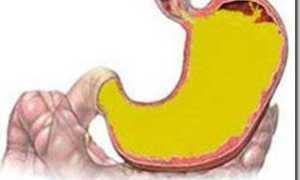 Желчь внутри желудка при гастроскопии: причины и последствия