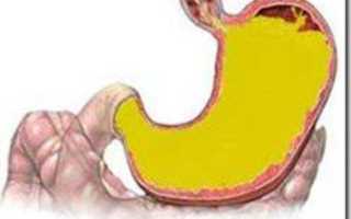Желчь внутри желудка при гастроскопии: причины и последствия