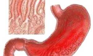 Температура от 37 °C и понос у взрослого: возможные причины и лечение