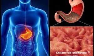 Супы, полезные при гастрите для здоровья
