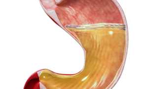 Семена льна при лечении гастрита: полезные свойства и рекомендации