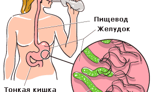 Понос и отрыжка яйцами: причины и лечение