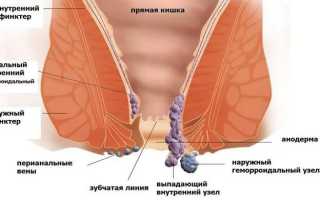 Боль в прямой кишке после дефекации: причины и лечение