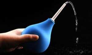 Лечение геморроидальных шишек (узлов) в домашних условиях