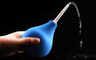 Лечение геморроидальных шишек (узлов) в домашних условиях