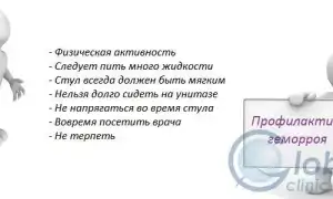 Профилактика появления геморроя для здоровья и комфорта