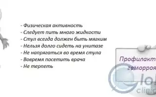 Профилактика появления геморроя для здоровья и комфорта