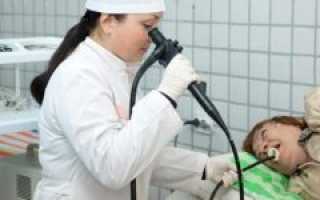 ФГДС желудка и кишечника: что это такое и зачем нужно