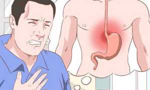 Поверхностный очаговый гастрит: причины и лечение