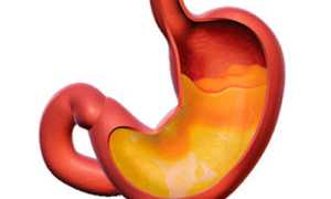 Что такое атрофический гастрит и его особенности