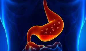 Гастрит эритематозный: причины и симптомы