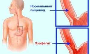 После процедуры гастроскопии: что ожидать и как подготовиться