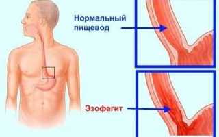 После процедуры гастроскопии: что ожидать и как подготовиться