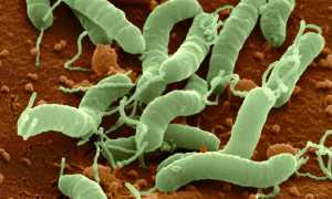 Гастрит гиперацидный: причины и лечение