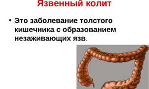 Понос с кровью у детей без температуры: причины и лечение