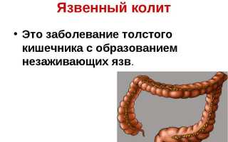 Понос с кровью у детей без температуры: причины и лечение