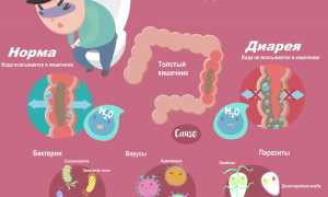 Понос и отрыжка: причины и лечение