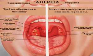 Кашель и понос у ребенка: причины и лечение