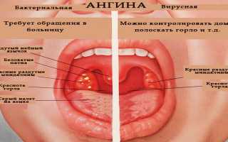 Кашель и понос у ребенка: причины и лечение