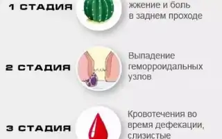 Зуд и жжение при геморрое: причины и лечение