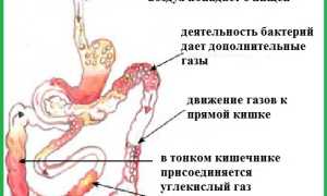 Сильное газообразование в кишечнике: причины и последствия