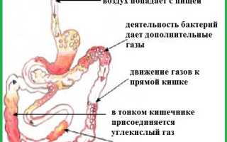 Сильное газообразование в кишечнике: причины и последствия