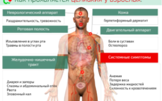 Анализ для диагностирования целиакии: важные аспекты и рекомендации