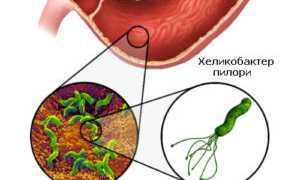 Выявление хеликобактер пилори по анализу крови: методы и рекомендации