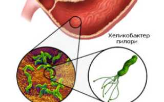 Выявление хеликобактер пилори по анализу крови: методы и рекомендации