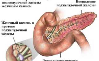 Вздутие и боли внизу живота: причины и лечение