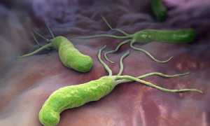 Детский гастродуоденит: причины и лечение