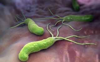 Детский гастродуоденит: причины и лечение