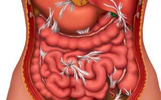 Сифонное клизмирование, алгоритм и его применение