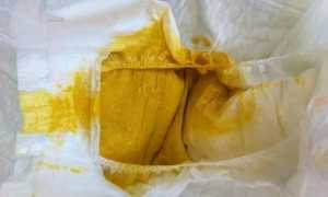 Как определить, понос или нет у грудничка: советы для родителей