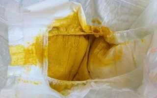 Как определить, понос или нет у грудничка: советы для родителей