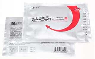 Китайский пластырь от геморроя: эффективное решение для здоровья