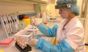 Анализы на хеликобактер пилори: важные аспекты и рекомендации