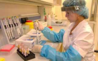 Анализы на хеликобактер пилори: важные аспекты и рекомендации